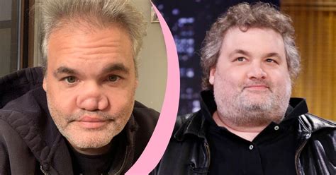 artie lange nose|Here’s What Happened to Artie Lange’s Nose